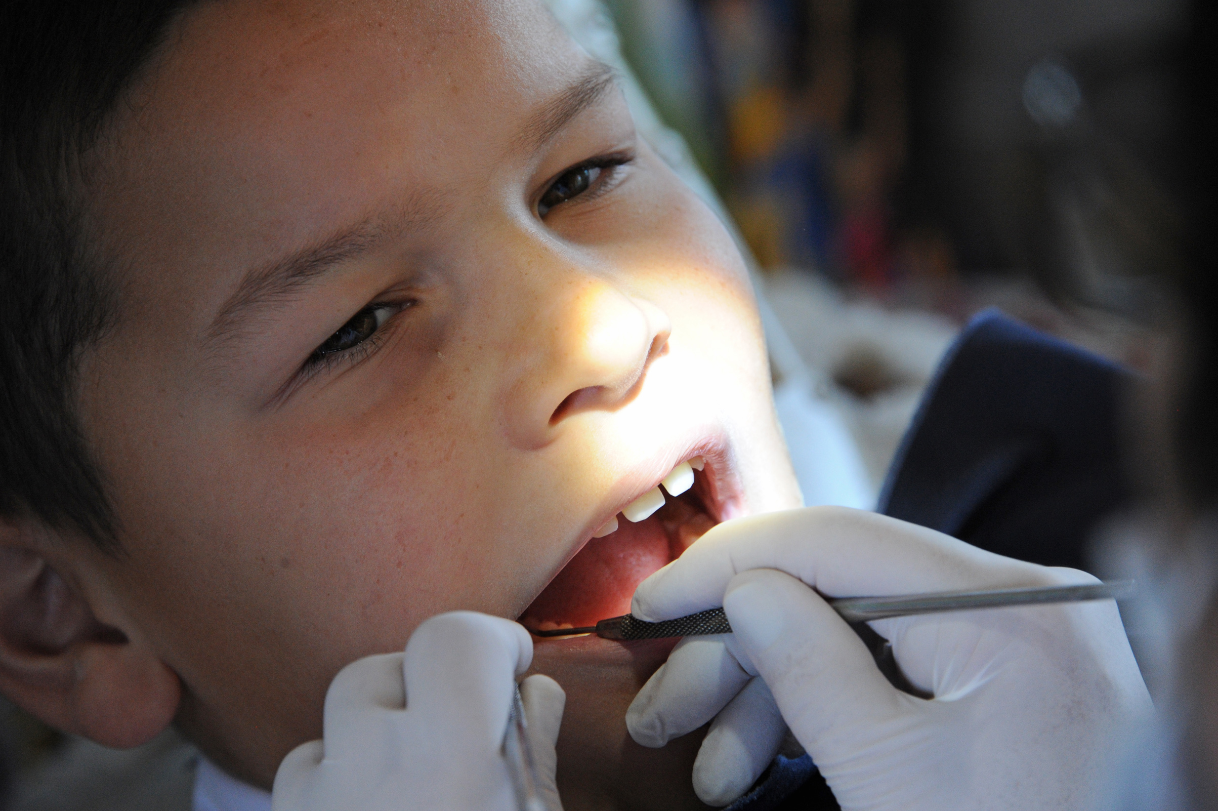 Atención odontológica del Programa de Salud Bucal en escuela rural n.º 42 de Treinta y Tres
