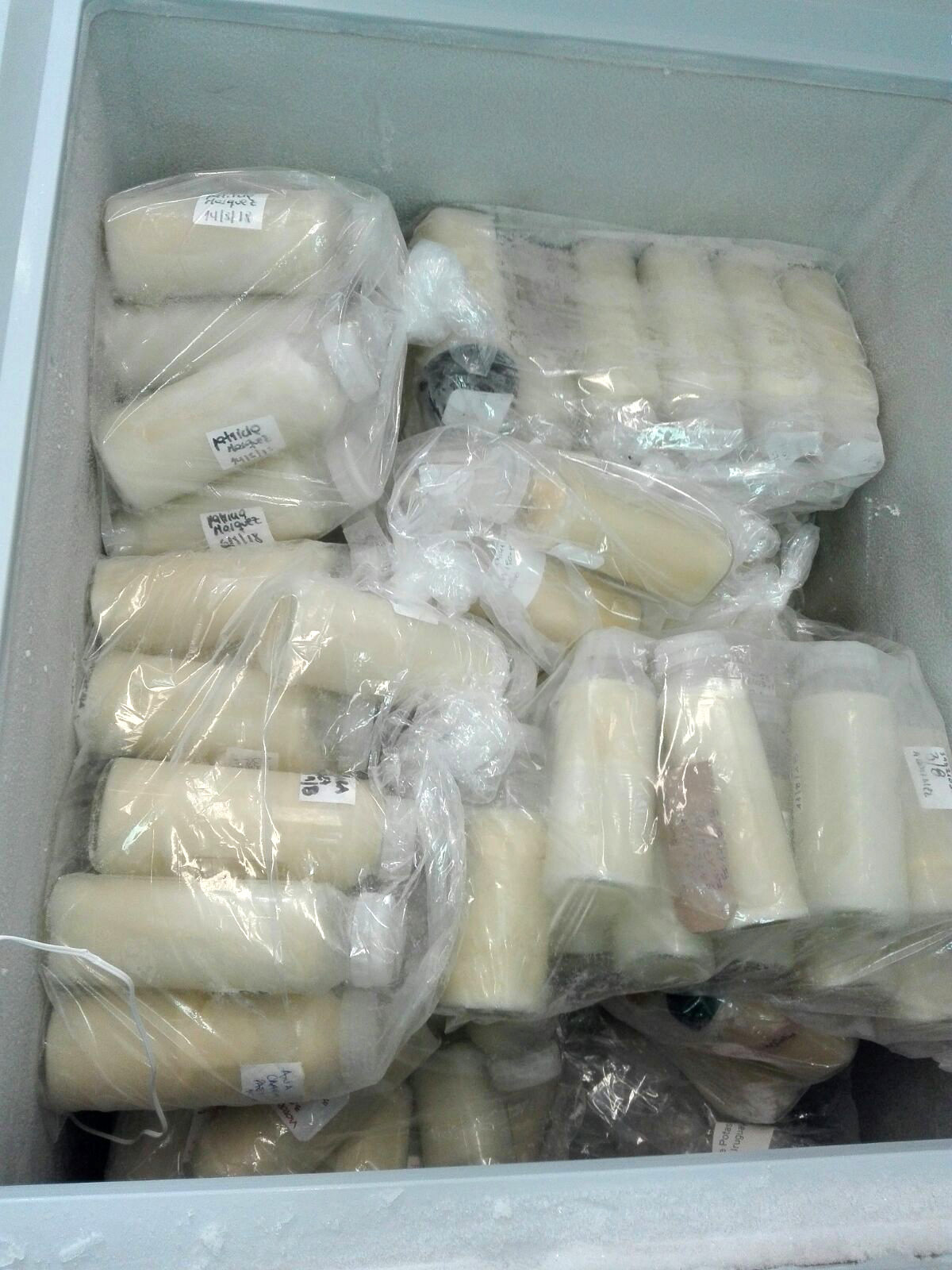 Banco de Leche Humana del hospital Pereira Rossell