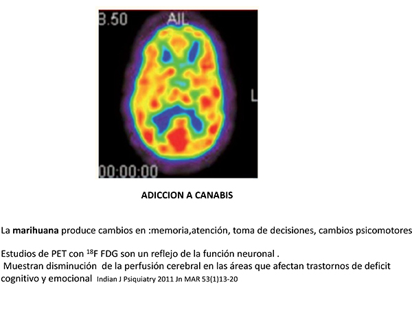 Imagen ampliada.