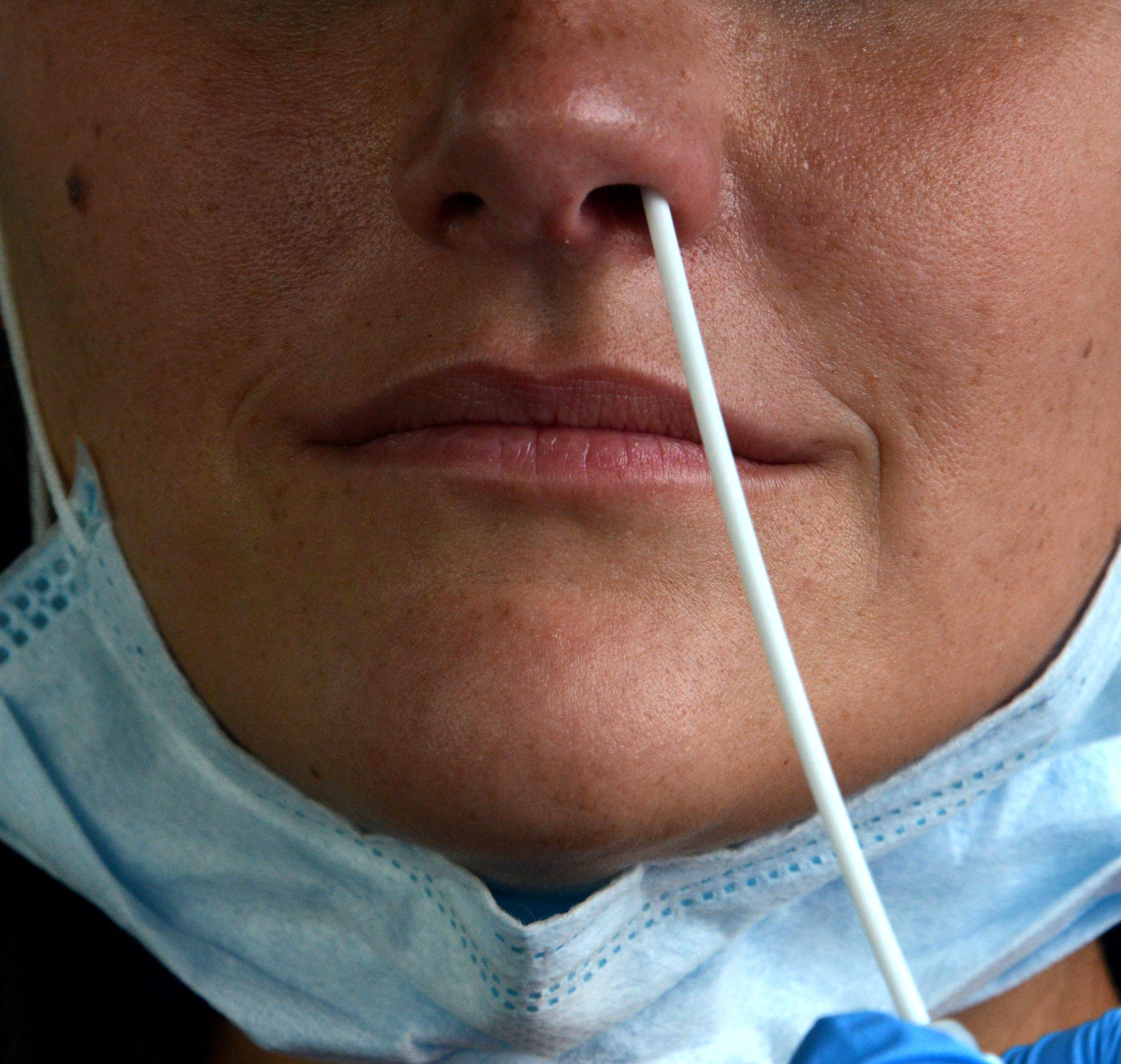 Recolección de muestra para análisis de coronavirus